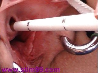 سخيف عنق الرحم وpeehole مع الأشياء استمناء مجرى البول